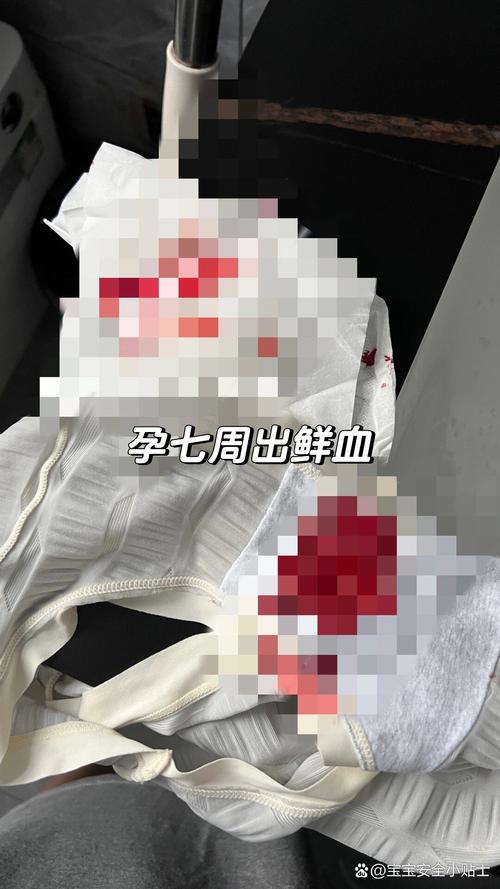 怀孕期间做梦梦到流血-第2张图片-郑州医学网