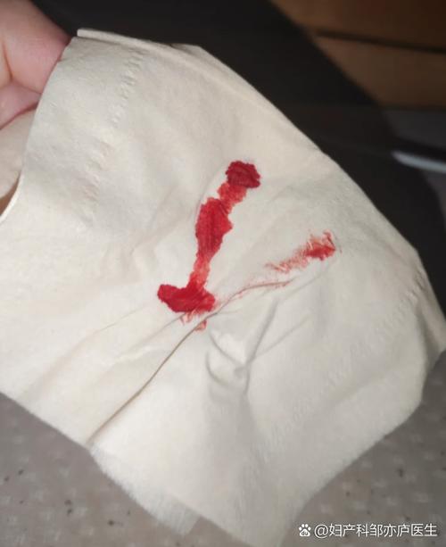 怀孕期间做梦梦到流血-第3张图片-郑州医学网
