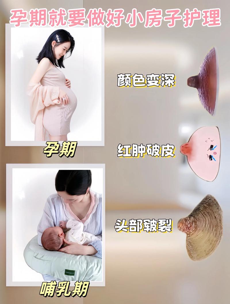 怀孕期间乳房变化图片能真实反映每个孕妈的身体变化吗？-第1张图片-郑州医学网