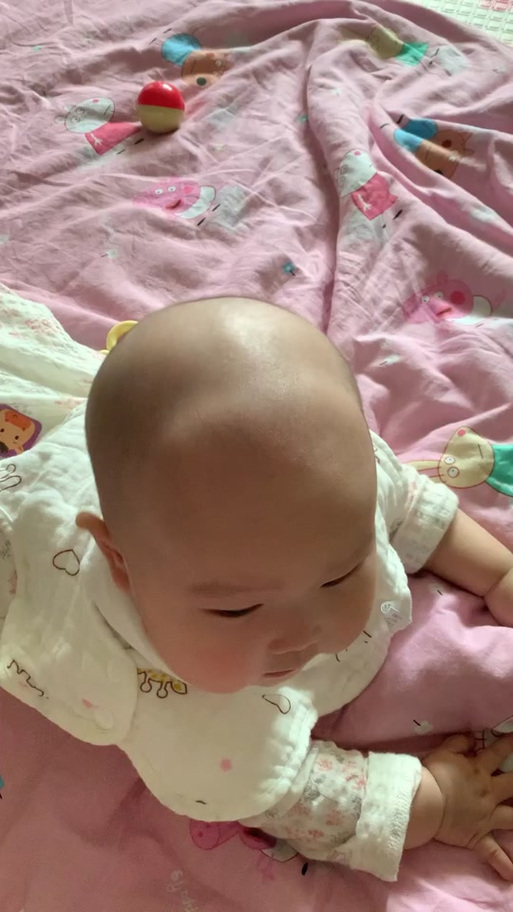 新生儿头骨突出是正常现象吗？需要担心什么问题？-第2张图片-郑州医学网