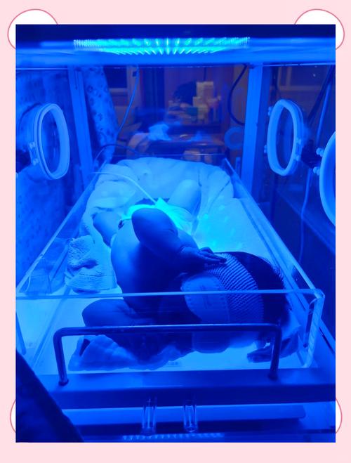 新生儿照蓝光真的难受吗？会对宝宝造成哪些影响？-第1张图片-郑州医学网