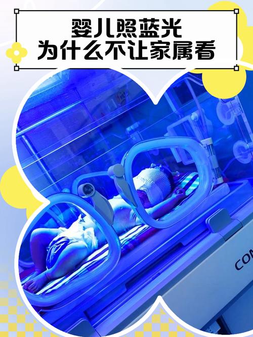 新生儿照蓝光真的难受吗？会对宝宝造成哪些影响？-第2张图片-郑州医学网