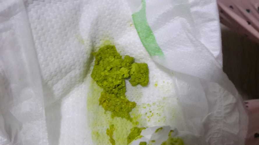 新生儿拉绿色奶瓣图片-第1张图片-郑州医学网