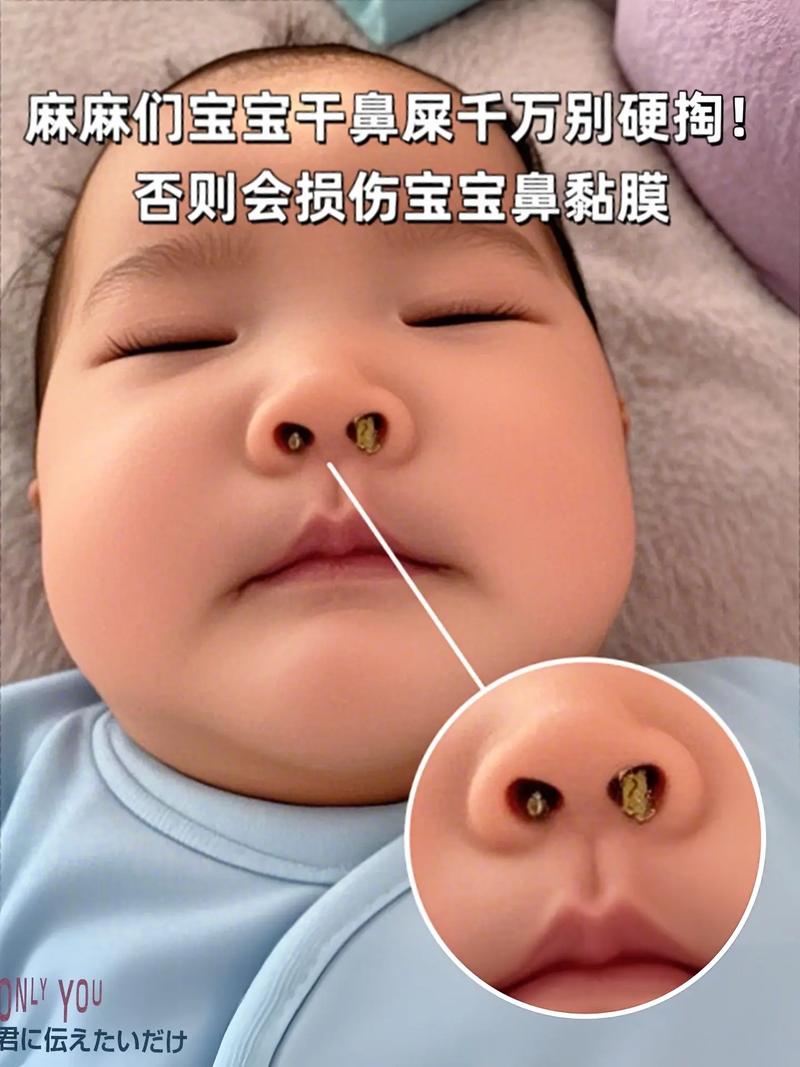 新生儿鼻子红怎么回事-第1张图片-郑州医学网