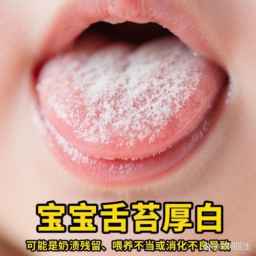 新生儿吃奶粉舌苔厚白是正常现象还是消化异常？如何判断是否需要干预？-第1张图片-郑州医学网