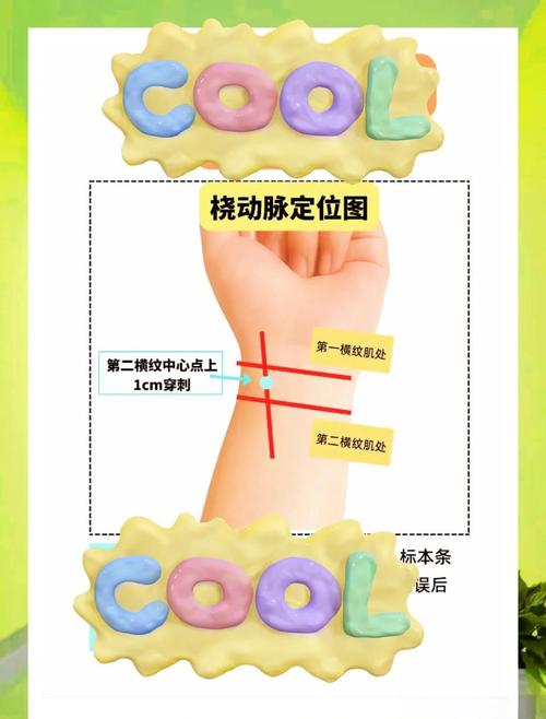 新生儿桡动脉定位图片，如何精准定位新生儿桡动脉？关键步骤与注意事项是什么？-第1张图片-郑州医学网