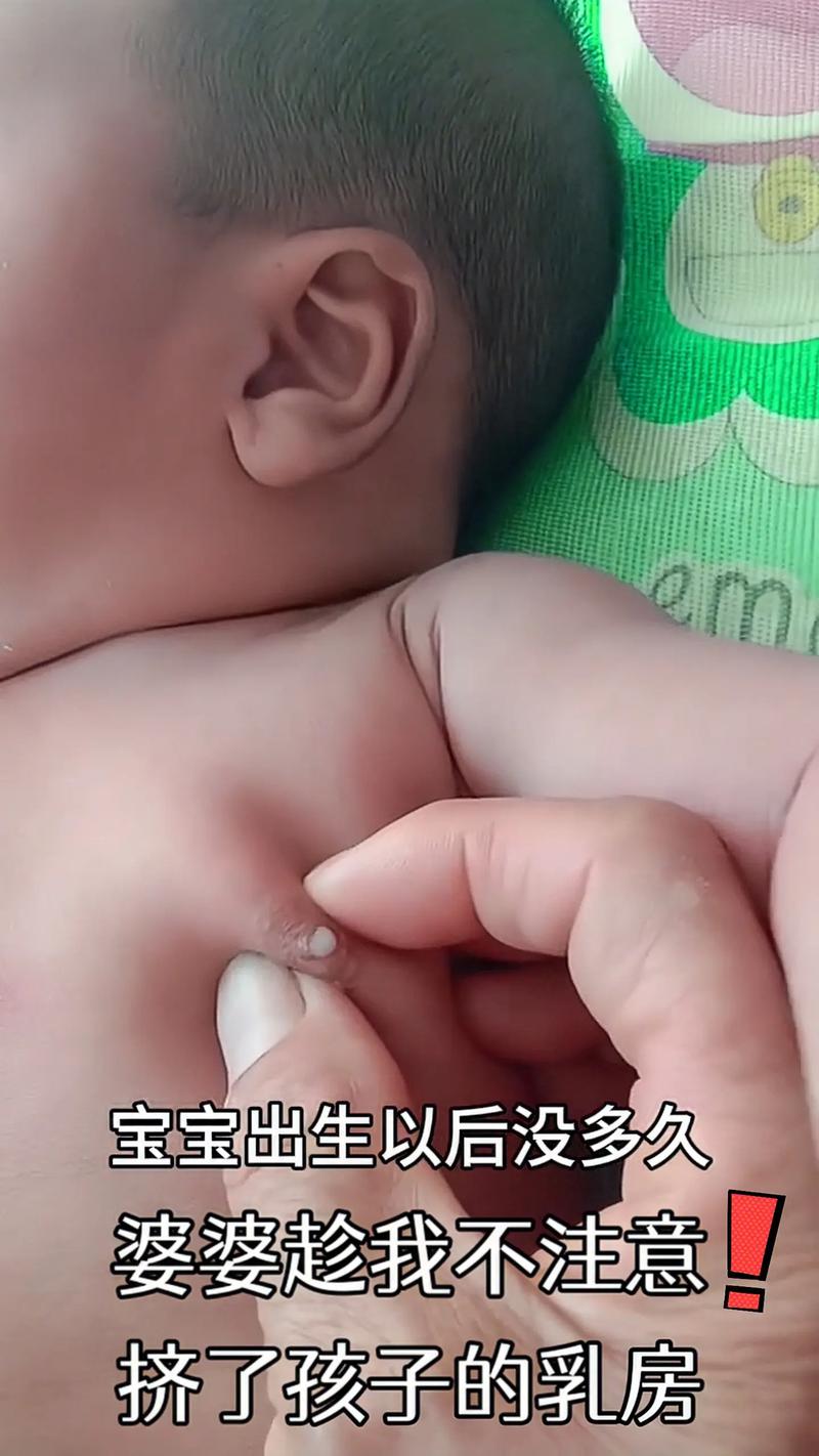 儿童乳头有硬块怎么办-第2张图片-郑州医学网