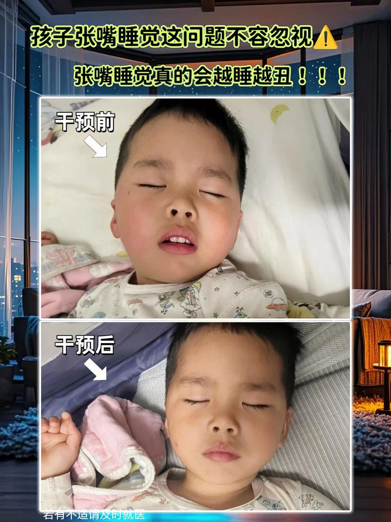 儿童张嘴睡觉怎么回事-第3张图片-郑州医学网