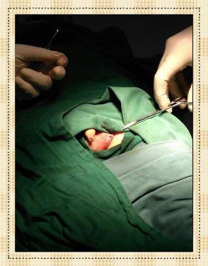 新生儿隐睾手术的成功率具体是多少？术后会影响生育功能吗？-第3张图片-郑州医学网