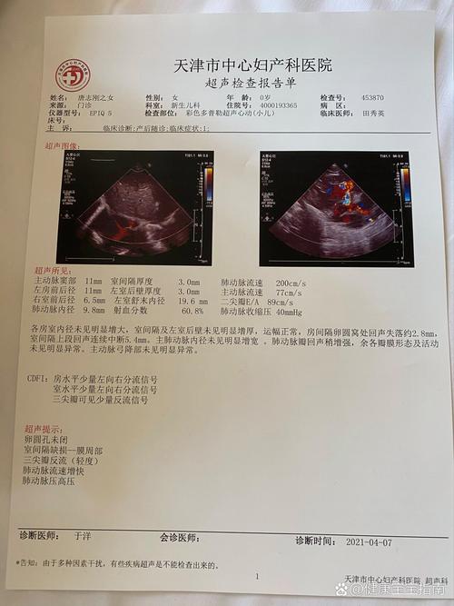 新生儿做心脏彩超有必要吗？哪些情况需要做？检查过程安全吗？-第2张图片-郑州医学网