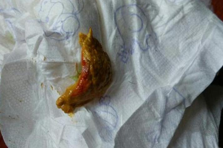 新生儿大便带血是严重信号吗？家长该如何紧急应对？-第1张图片-郑州医学网