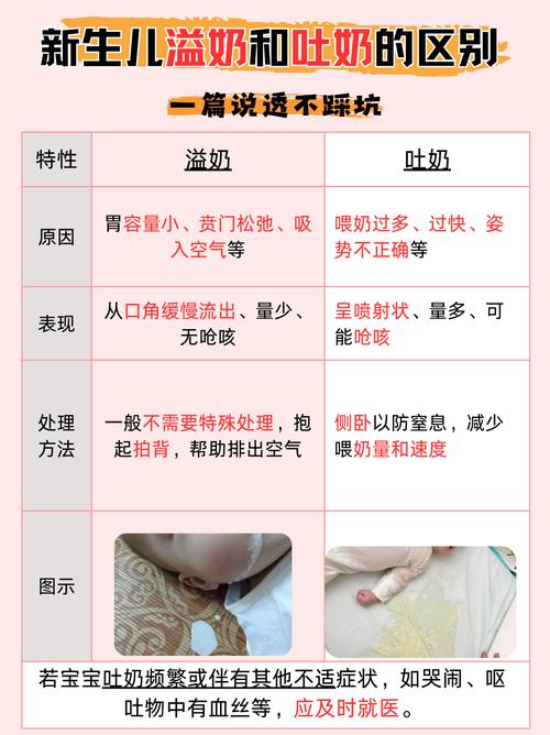 新生儿总是漾奶是正常现象还是生病信号？该如何科学护理？-第2张图片-郑州医学网