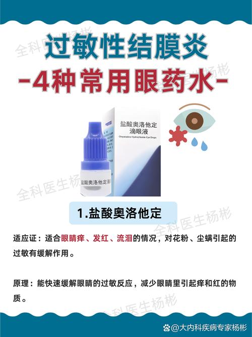 儿童过敏性结膜炎用药，如何选药才能安全有效又防复发？-第3张图片-郑州医学网