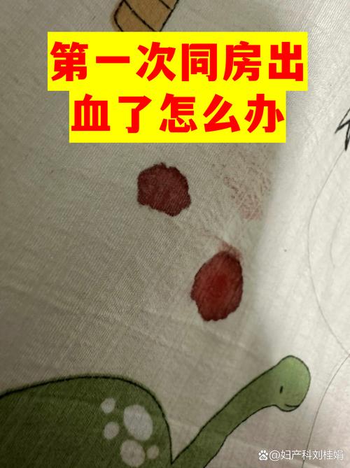 怀孕期间同房后出血，是正常现象还是危险信号？-第2张图片-郑州医学网