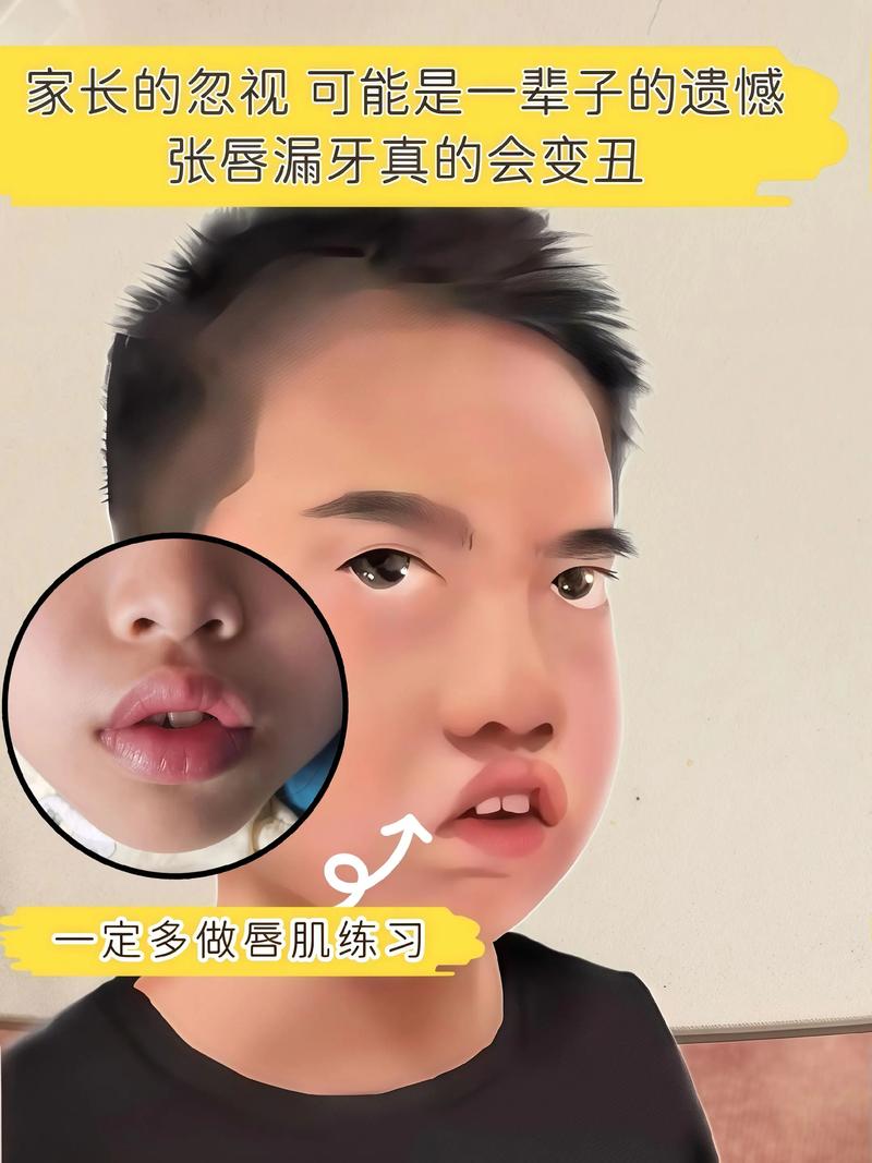 新生儿丑变漂亮对比照背后藏着哪些成长秘密？-第2张图片-郑州医学网