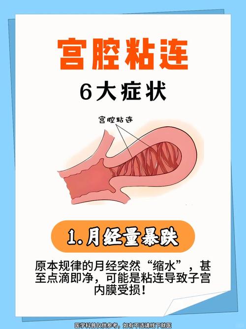 孕期发现宫腔粘连带会引发哪些风险？如何科学处理才能保障母婴安全？-第1张图片-郑州医学网