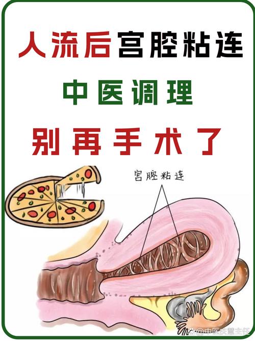 孕期发现宫腔粘连带会引发哪些风险？如何科学处理才能保障母婴安全？-第2张图片-郑州医学网