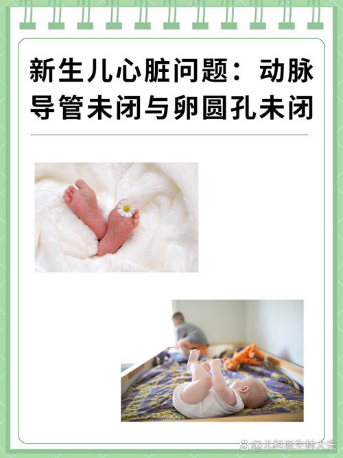 新生儿出生时会做心脏检查吗？这项检查具体怎么做？-第1张图片-郑州医学网