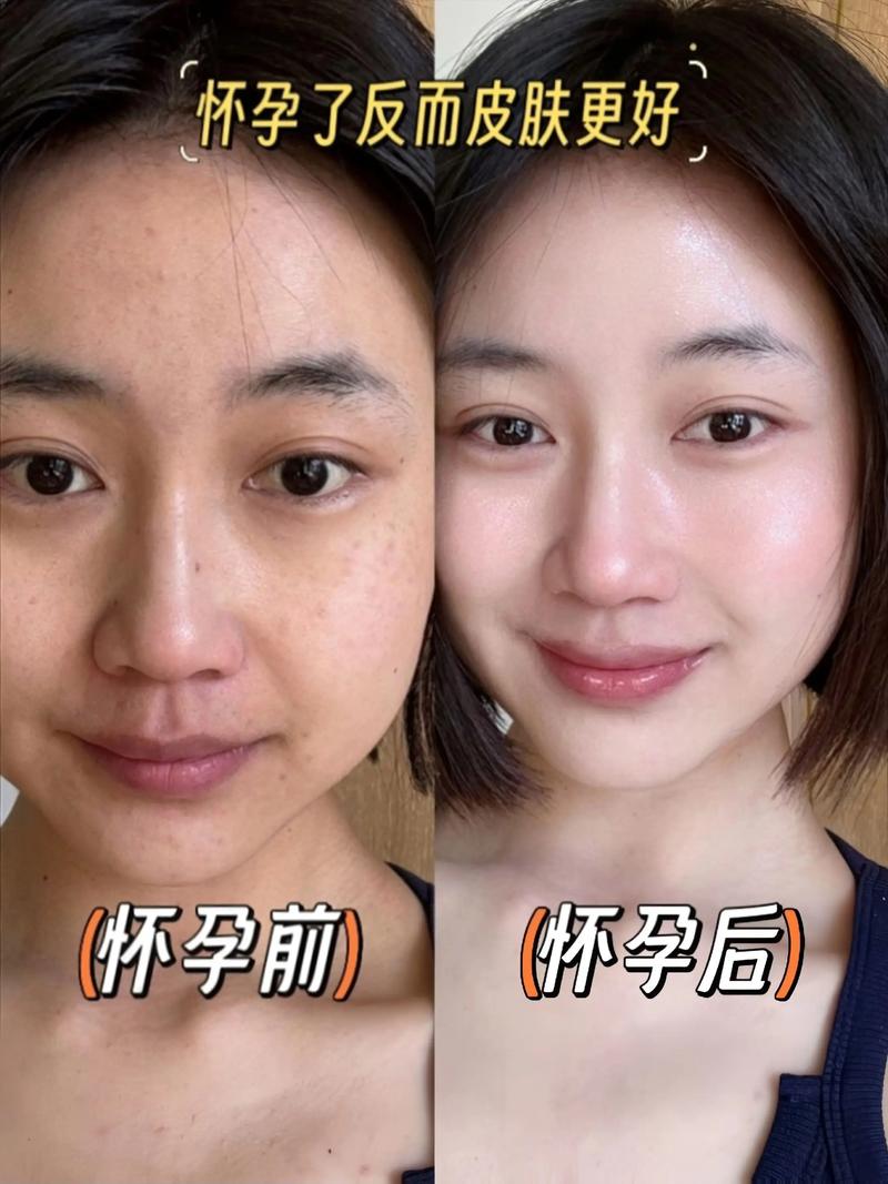 孕期脸干燥起皮难缓解？如何科学护理敏感肌又保障胎儿安全？-第2张图片-郑州医学网