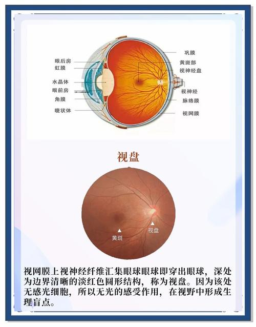新生儿视网膜筛查具体包含哪些步骤？家长需要提前了解哪些注意事项？-第3张图片-郑州医学网