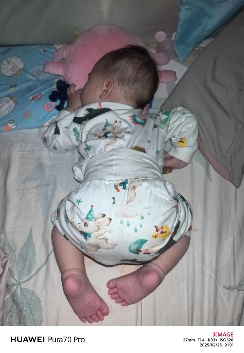 新生儿趴着晒太阳是否科学？对发育与安全有何潜在影响？-第3张图片-郑州医学网