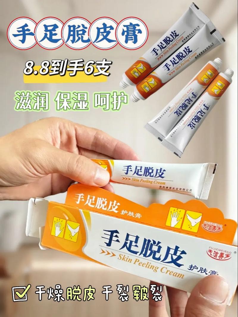儿童手脚脱皮用什么药？安全有效的药物选择与注意事项有哪些？-第1张图片-郑州医学网