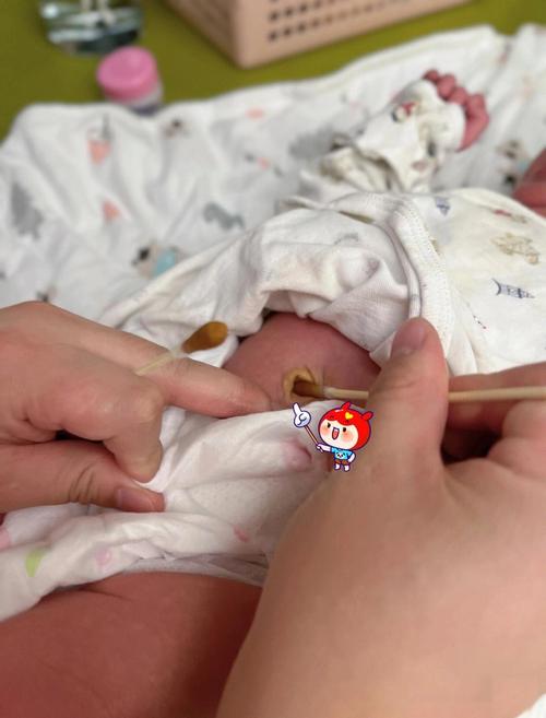 新生儿脐带脱落后出血怎么办？需要立即就医还是家庭处理？-第1张图片-郑州医学网
