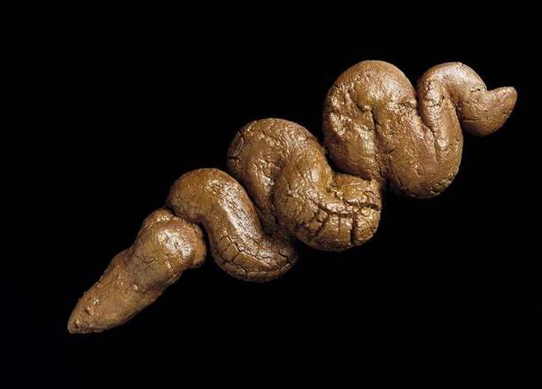 怀孕期间拉屎是黑色，是正常现象还是身体在报警？-第1张图片-郑州医学网