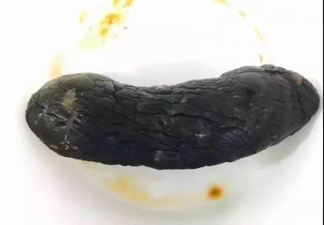 怀孕期间拉屎是黑色，是正常现象还是身体在报警？-第2张图片-郑州医学网