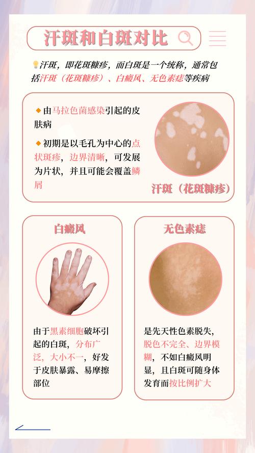 怀孕期间长汗斑是正常的生理现象还是健康预警？-第2张图片-郑州医学网