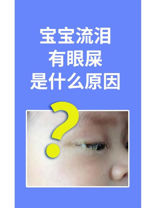 新生儿为什么总爱长眼屎？是上火还是生病了？新手爸妈别慌！-第1张图片-郑州医学网