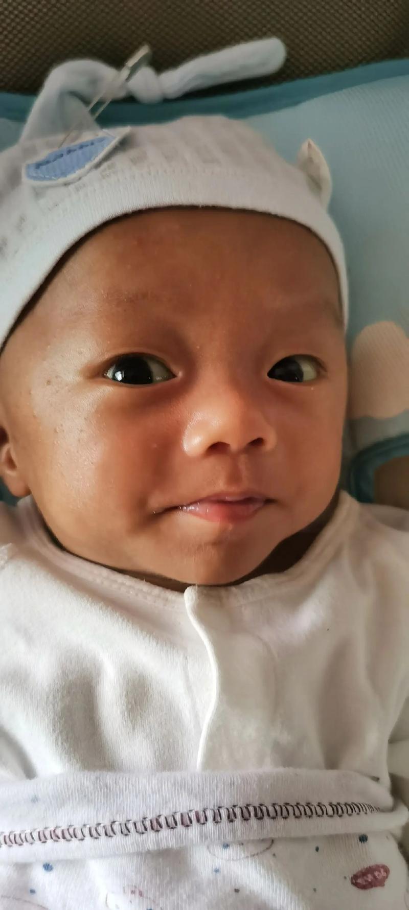 新生儿肝炎早期症状隐匿，家长该如何识别黄疸、厌食等异常信号？-第3张图片-郑州医学网