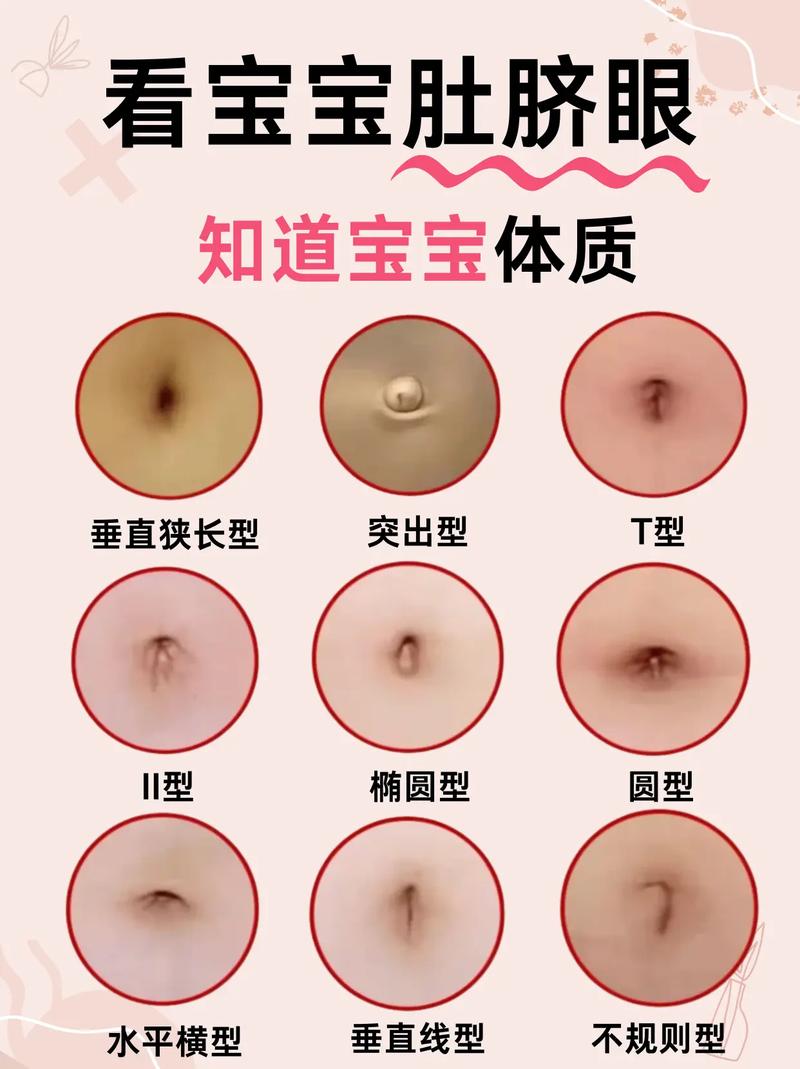 新生儿肚子像青蛙鼓胀是正常现象吗？需要警惕哪些潜在问题？-第3张图片-郑州医学网