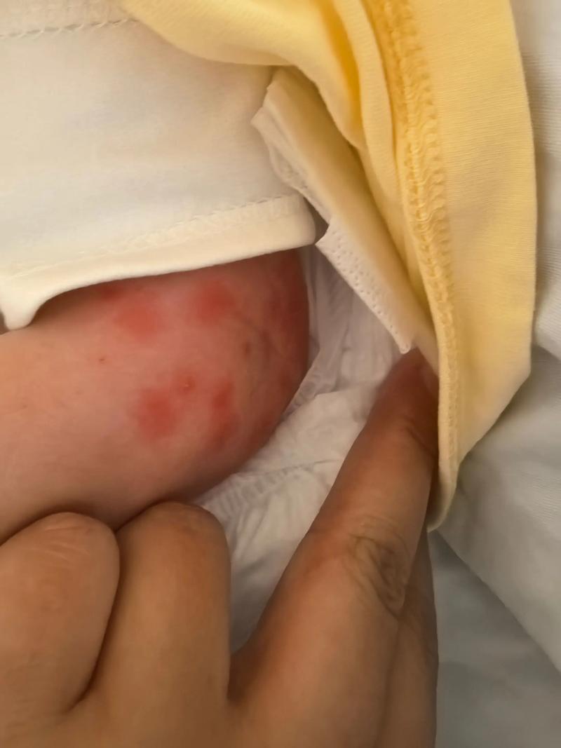 新生儿出现上热症状具体有哪些表现？家长该如何初步判断与应对？-第1张图片-郑州医学网