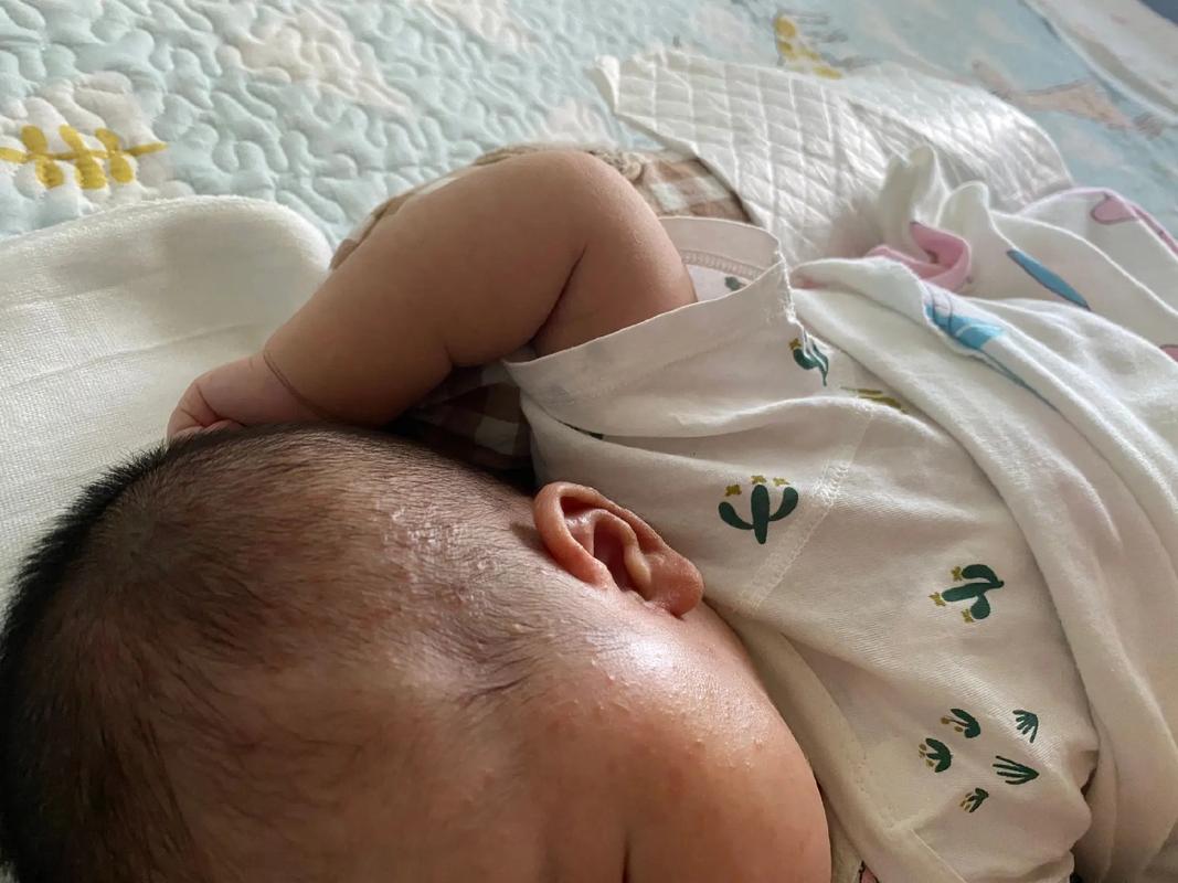 新生儿出现上热症状具体有哪些表现？家长该如何初步判断与应对？-第3张图片-郑州医学网