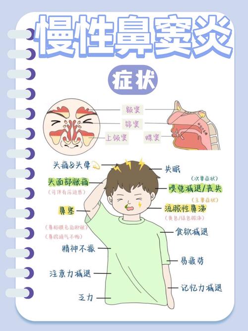 儿童鼻窦炎的症状表现-第1张图片-郑州医学网 儿童鼻窦炎的症状表现-第1张图片-郑州医学网