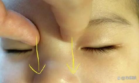 新生儿泪腺炎按摩图片正确手法步骤是怎样的？-第1张图片-郑州医学网