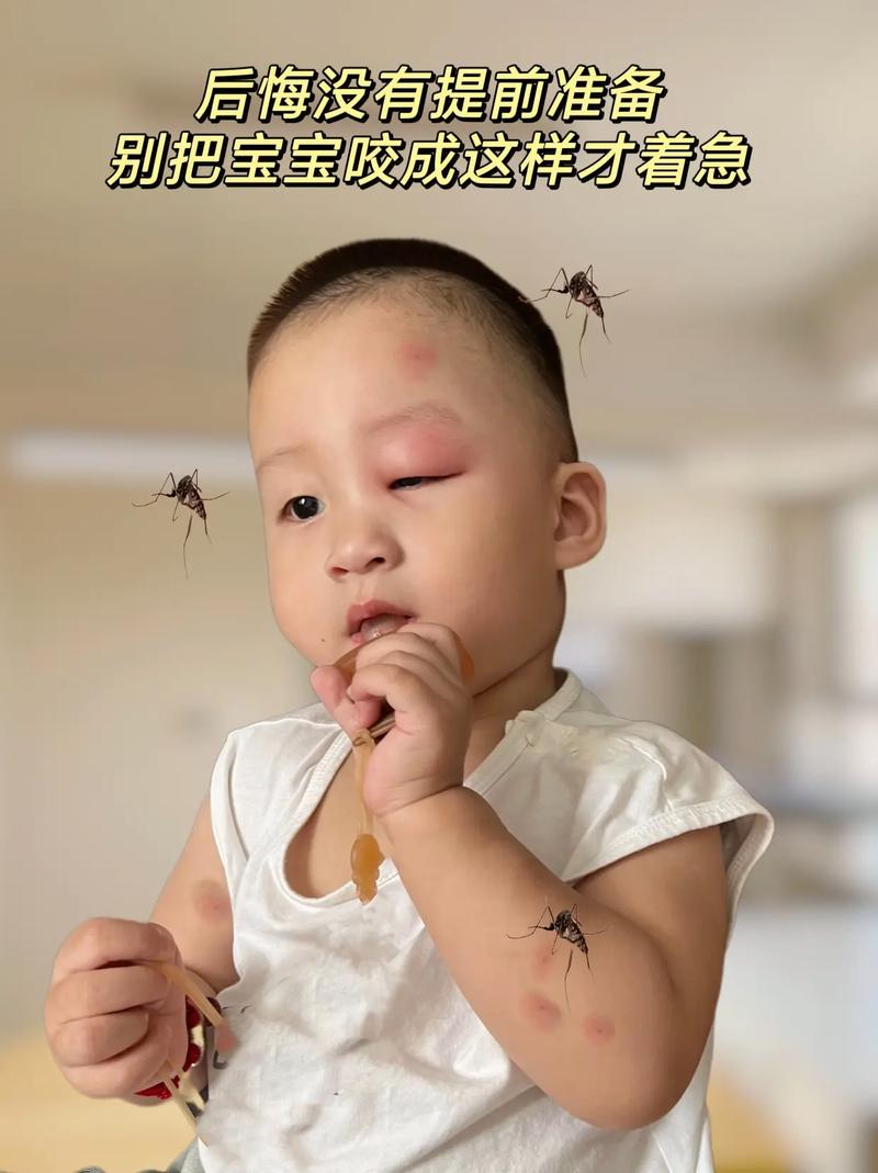 未满月新生儿被蚊子咬了怎么办？能用药吗？如何正确处理？-第1张图片-郑州医学网