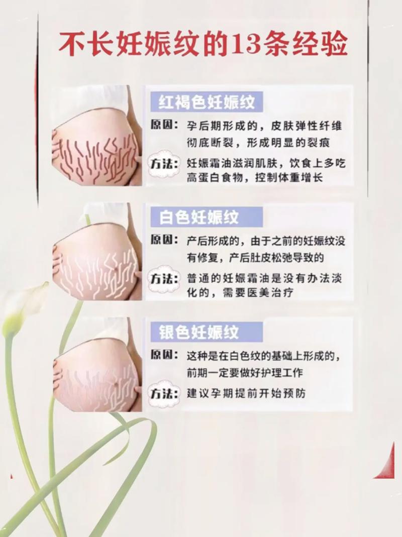 孕期长妊娠纹真的能抑制吗？有没有科学方法能减少或避免妊娠纹的出现？-第1张图片-郑州医学网