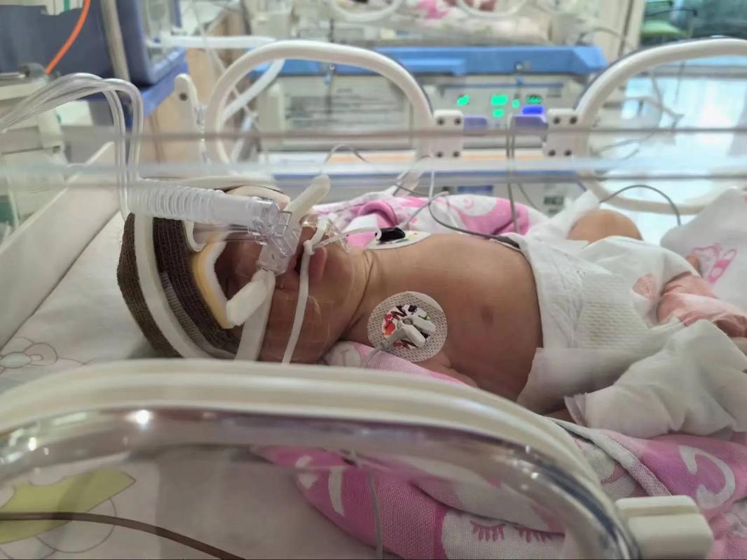 新生儿败血症治疗的最佳时间窗口究竟有多关键？错过会有哪些不可逆影响？-第1张图片-郑州医学网