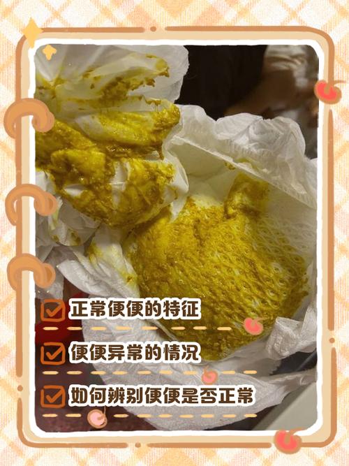 新生儿吃双歧杆菌后排便改善,是正常调节还是需警惕其他健康信号?-第1张图片-郑州医学网 新生儿吃双歧杆菌后排便改善,是正常调节还是需警惕其他健康信号?-第1张图片-郑州医学网