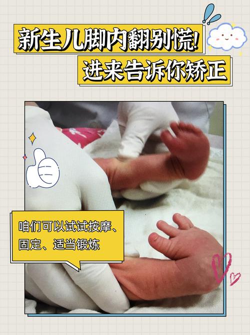 新生儿脚有劲就一定不是脑瘫吗？这些细节家长千万别忽视！-第3张图片-郑州医学网