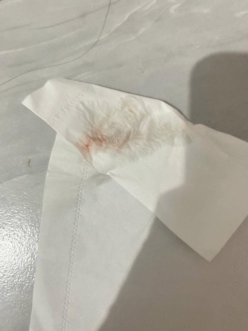 怀孕期间出现炎症出血,会对胎儿造成哪些不良影响?-第1张图片-郑州医学网 怀孕期间出现炎症出血,会对胎儿造成哪些不良影响?-第1张图片-郑州医学网