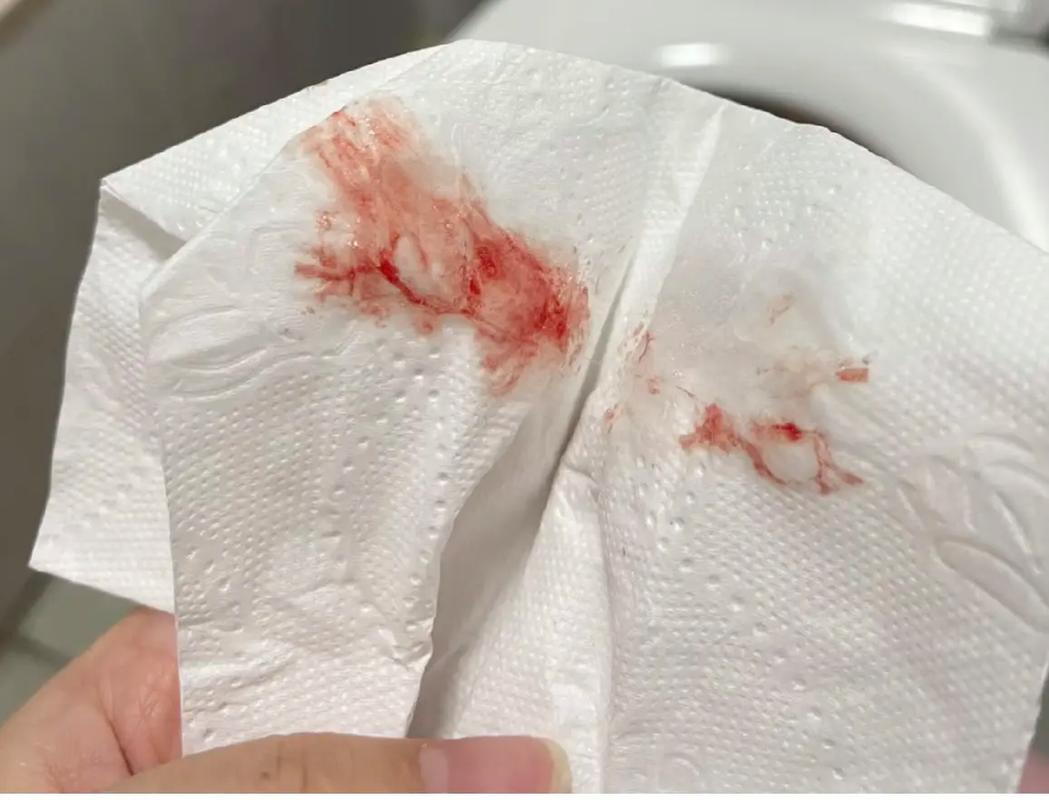 怀孕期间出现炎症出血，会对胎儿造成哪些不良影响？-第3张图片-郑州医学网