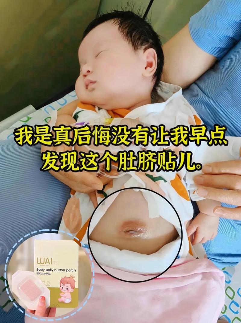 新生儿哭闹频繁是否会刺激肚脐引发感染或异常?-第3张图片-郑州医学网 新生儿哭闹频繁是否会刺激肚脐引发感染或异常?-第3张图片-郑州医学网