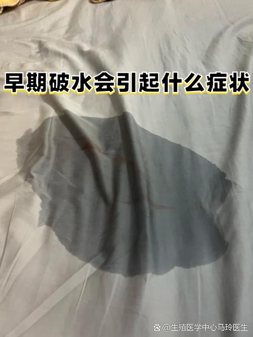 怀孕期间羊水破了到底是什么感觉？和尿失禁要怎么区分呢？-第3张图片-郑州医学网