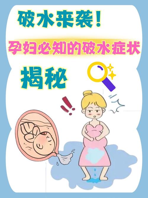 怀孕期间羊水破了到底是什么感觉？和尿失禁要怎么区分呢？-第2张图片-郑州医学网