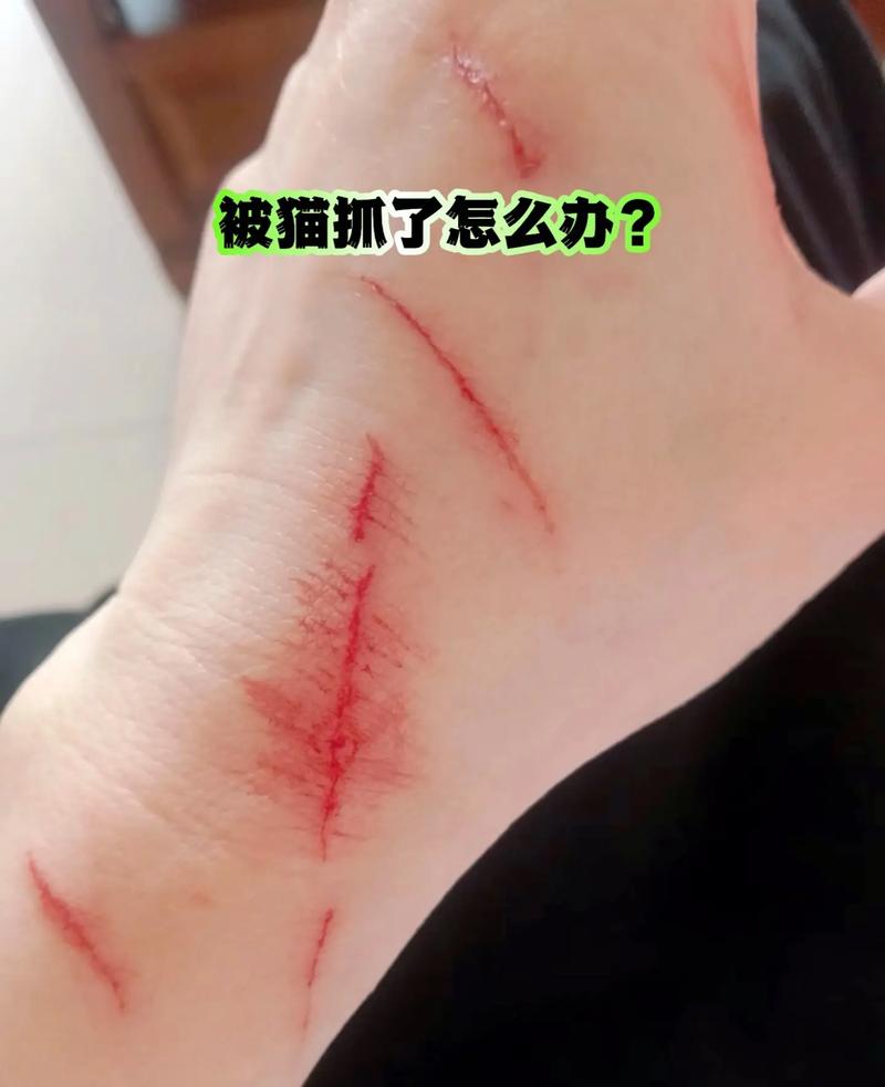 孕期被猫抓出血会感染弓形虫吗?紧急处理和胎儿安全指南-第2张图片-郑州医学网 孕期被猫抓出血会感染弓形虫吗?紧急处理和胎儿安全指南-第2张图片-郑州医学网