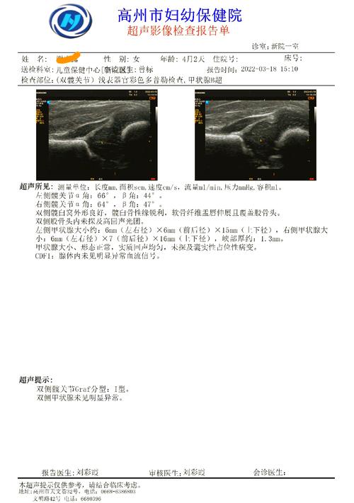 新生儿足跟血筛查官网入口在哪？怎么查结果？附详细操作指南！-第3张图片-郑州医学网