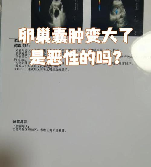 怀孕期间发现卵巢囊肿,会对胎儿和孕妇造成哪些影响?-第2张图片-郑州医学网 怀孕期间发现卵巢囊肿,会对胎儿和孕妇造成哪些影响?-第2张图片-郑州医学网